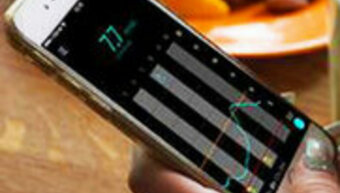 Smart continuous glucose monitoring system