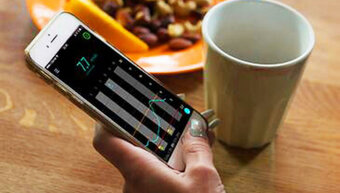 Smart continuous glucose monitoring system