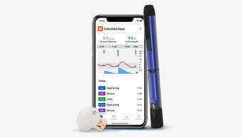 Smart continuous glucose monitoring system