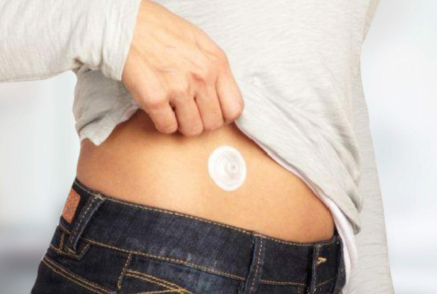 i-Port Advance ™ injection port
