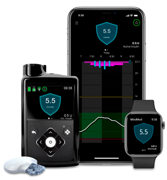 And a control algorithm that adjusts insulin delivery based on the CGM readings