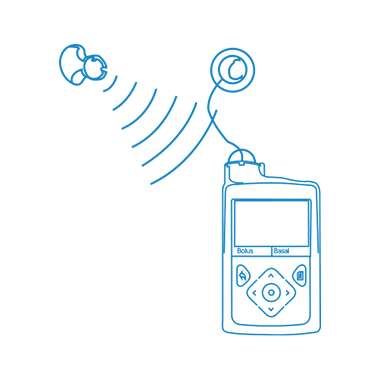 Continuous Glucose Monitoring (CGM)