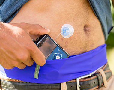 INFUSION SETS MiniMed® Mio™