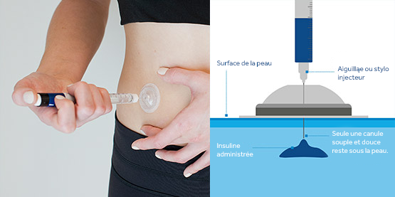 i-Port Advance™