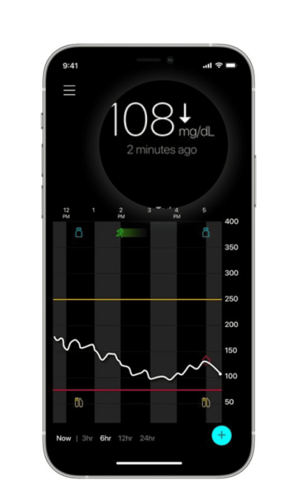Real-time sensor glucose