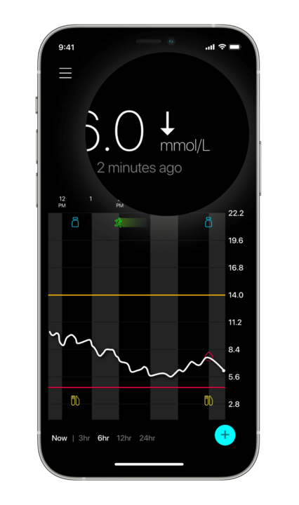 Glucose trend arrow