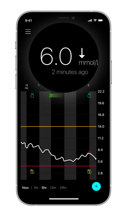 Real-time sensor glucose
