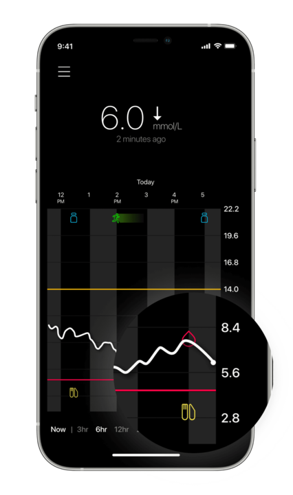 Sensor glucose trend line