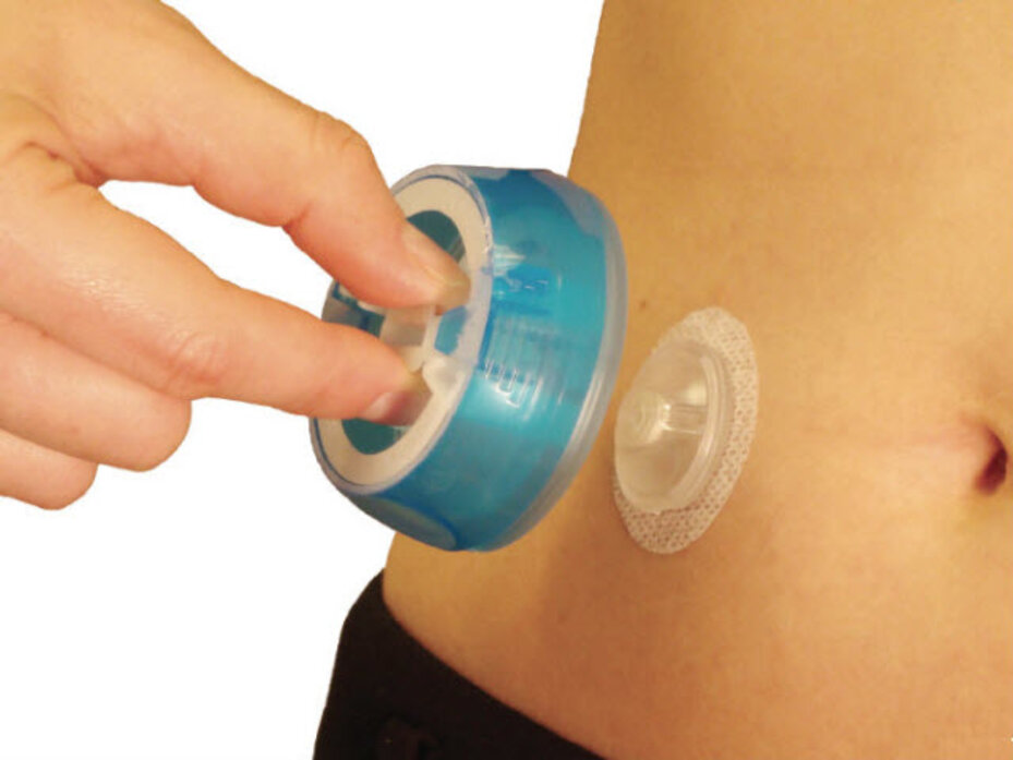 I-PORT ADVANCE™ WHO KNEW SOMETHING SO SMALL COULD MAKE SUCH A BIG DIFFERENCE