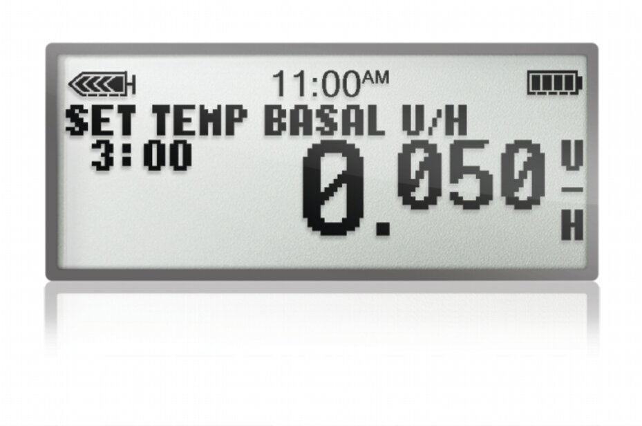 Adapting your basal rate temporarily to better fit your daily activity