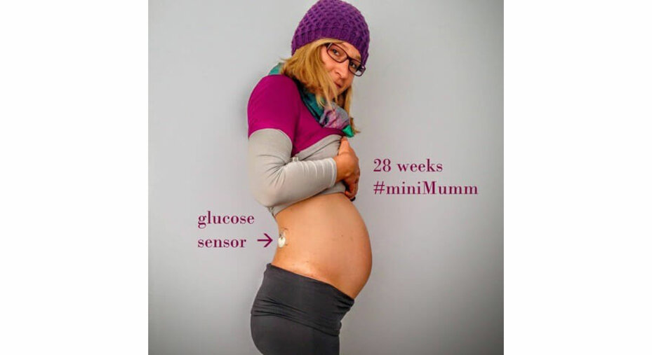 Anina’s Experience While Expecting