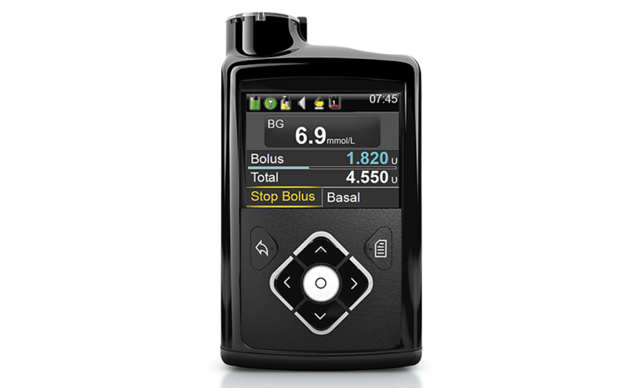 CGM