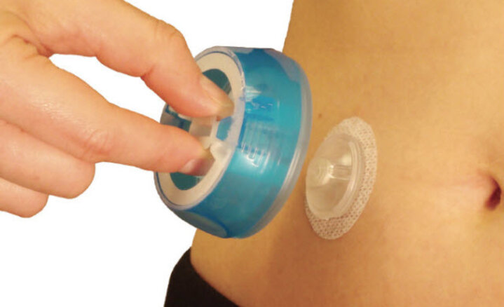 I-PORT ADVANCE™ WHO KNEW SOMETHING SO SMALL COULD MAKE SUCH A BIG DIFFERENCE
