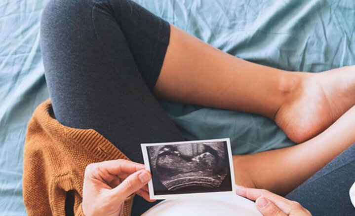 GRAVIDANZA & MICROINFUSORE. UNA MAMMA CON DIABETE DI TIPO 1 GRAVIDANZA & MICROINFUSORE. UNA MAMMA CON DIABETE DI TIPO 1