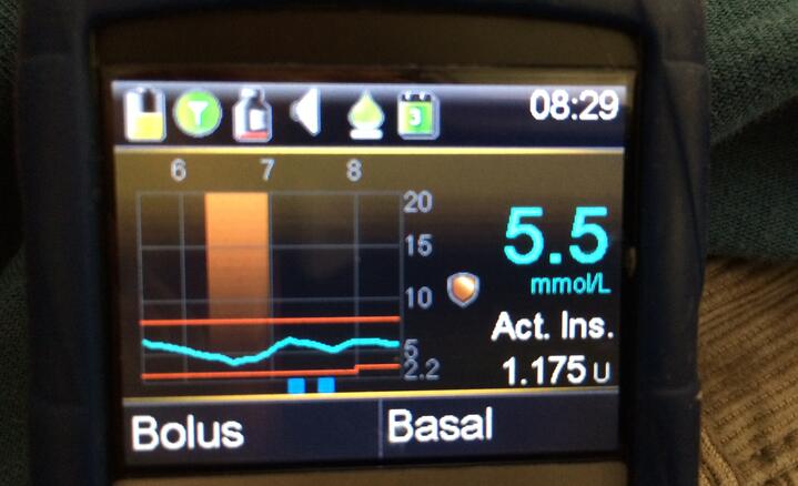 T1D