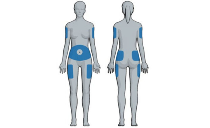  Lumps And Bumps