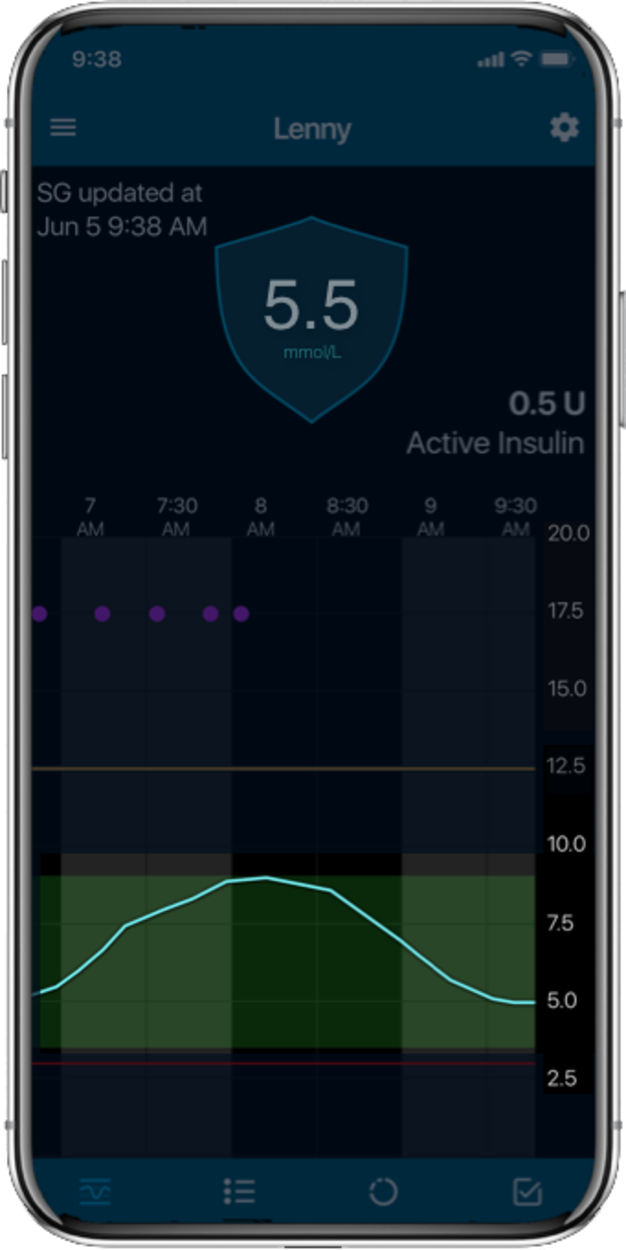 Glucose trend over time
