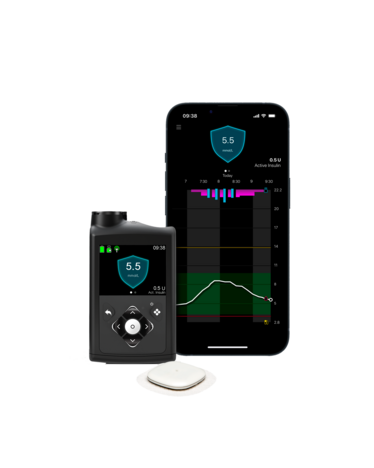 CGM