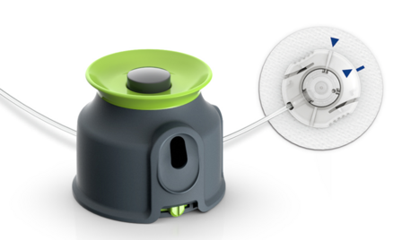 Insulin Pump Therapy