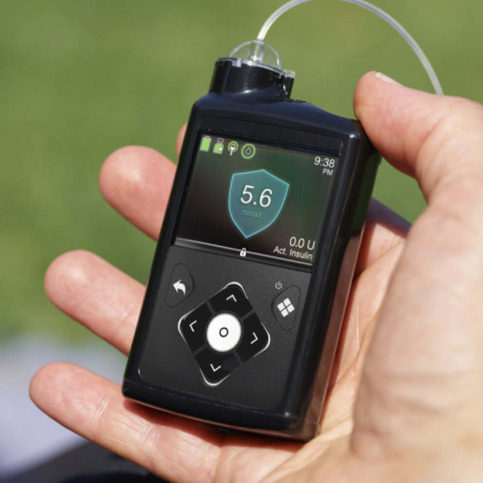Self-adjusting insulin pump Self-adjusting insulin pump