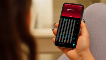 Smart continuous glucose monitoring system