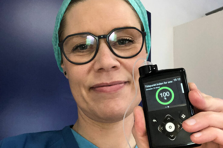 Livet med type 1-diabetes og moderne teknologi