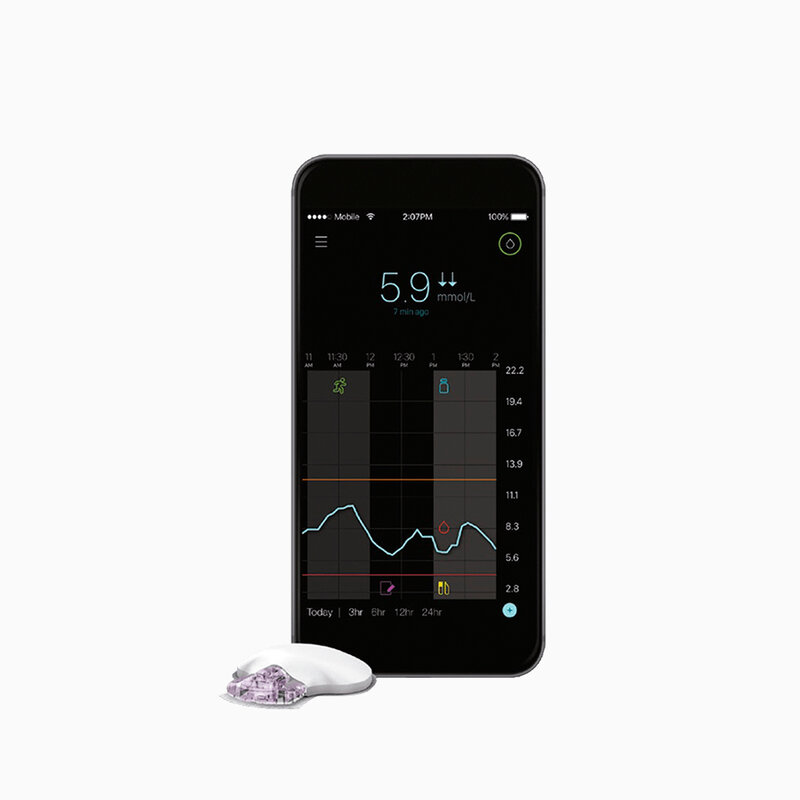 CGM