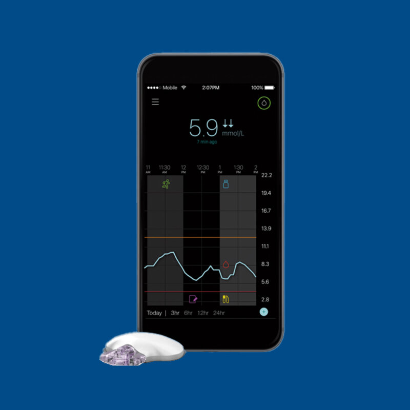 Continuous Glucose Monitoring