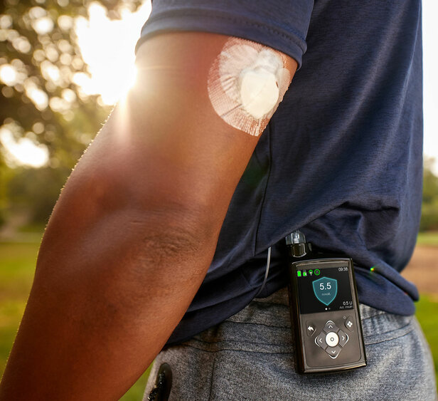 Insulin Pump