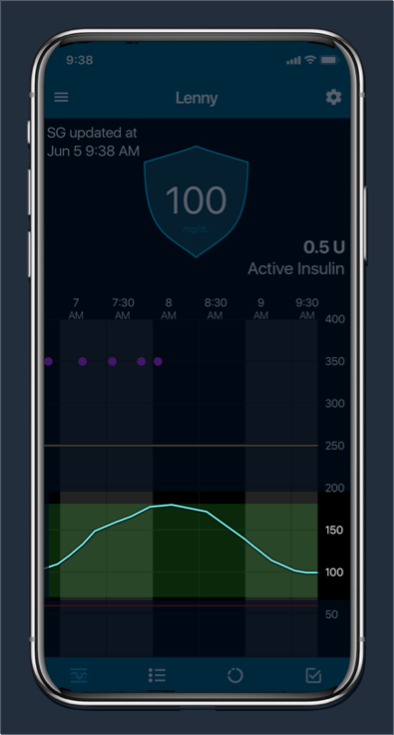 Glucose trend Over time