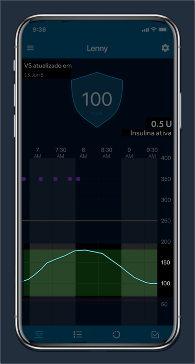 Glucose trend Over time