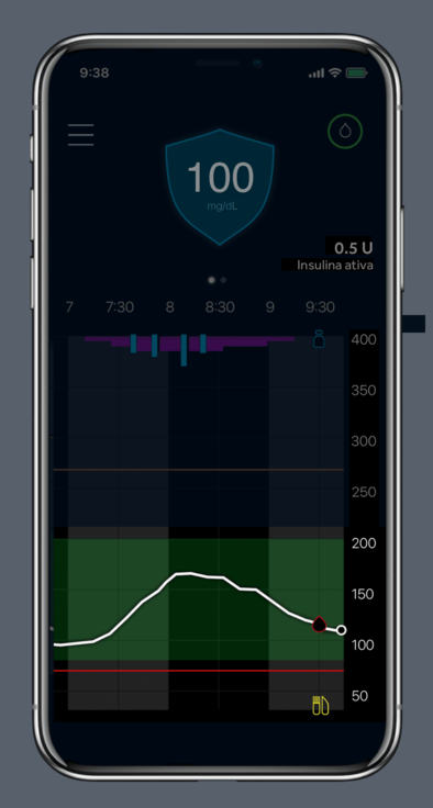 Glucose trend