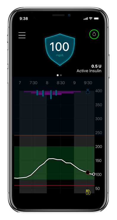 Glucose trend Over time