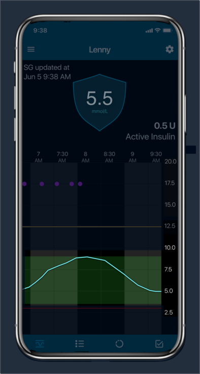 Glucose trend Over time