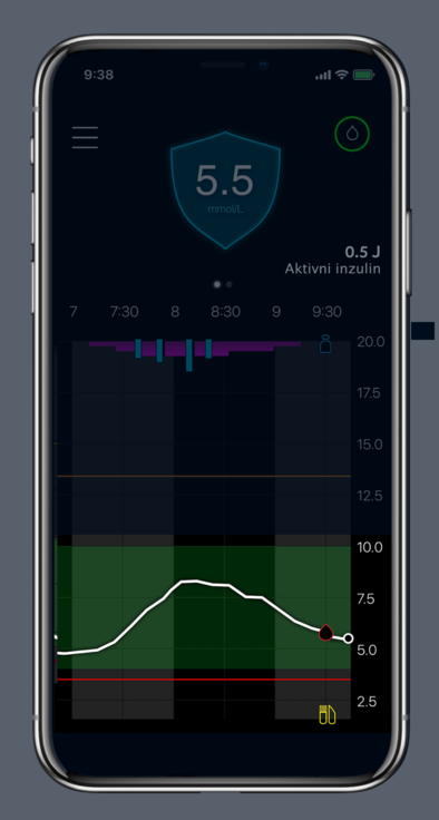 Glucose trend