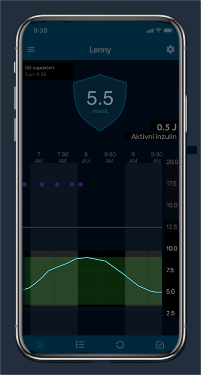 Glucose trend Over time