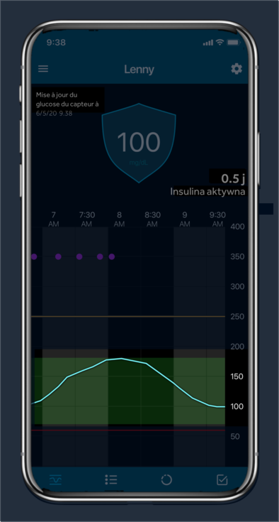 Glucose trend Over time