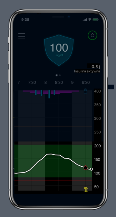Glucose trend Over time