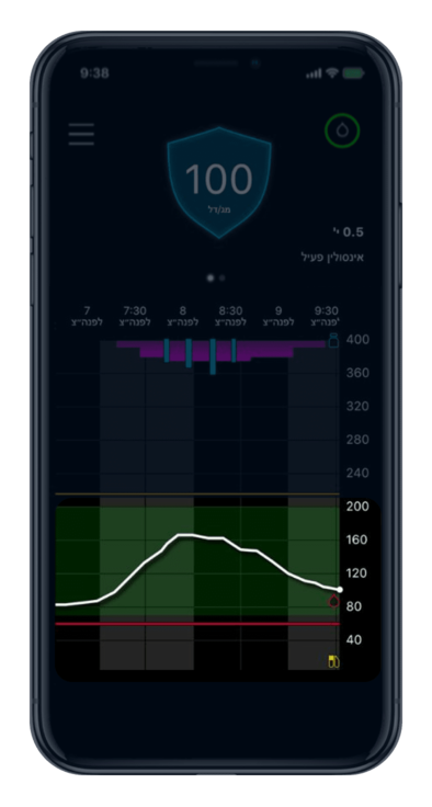 Glucose trend Over time