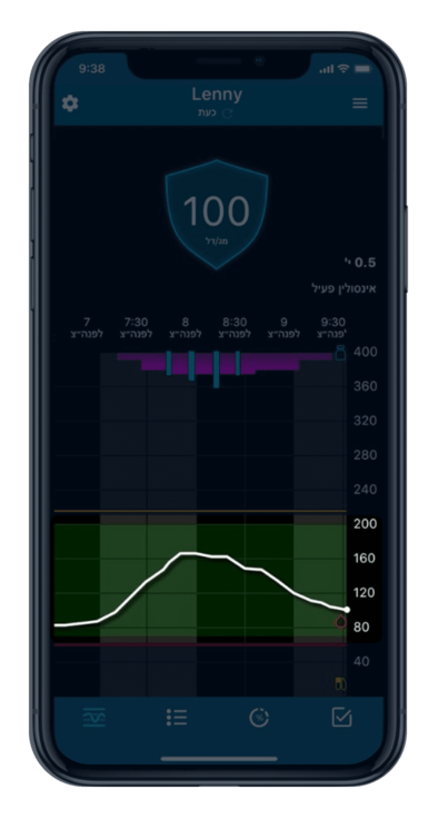 Glucose trend Over time