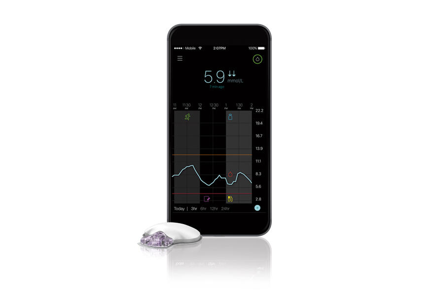 Continuous Glucose Monitoring
