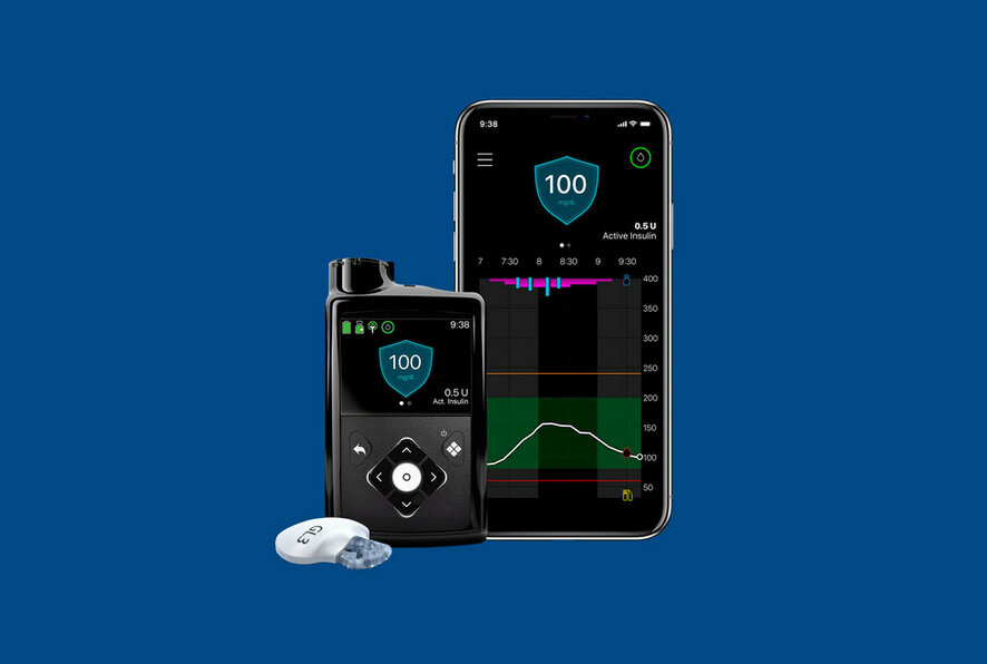 What is CGM?
