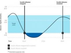 Low Glucose alarm graph